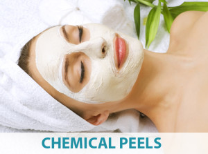 Chemical Peels